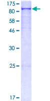 ab159144 on a 12.5% SDS-PAGE stained with Coomassie Blue.