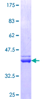 ab159146 on a 12.5% SDS-PAGE stained with Coomassie Blue.