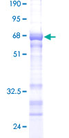 ab163466 on a 12.5% SDS-PAGE stained with Coomassie Blue.