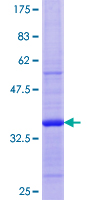ab163467 on a 12.5% SDS-PAGE stained with Coomassie Blue.