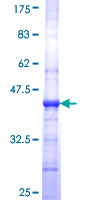 ab153539 on a 12.5% SDS-PAGE stained with Coomassie Blue.