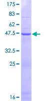ab166543 on a 12.5% SDS-PAGE stained with Coomassie Blue.