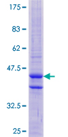 ab165441 on a 12.5% SDS-PAGE stained with Coomassie Blue.
