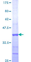 ab161404 on a 12.5% SDS-PAGE stained with Coomassie Blue.