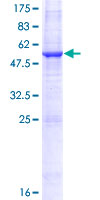 ab159974 on a 12.5% SDS-PAGE stained with Coomassie Blue.