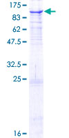 ab164775 on a 12.5% SDS-PAGE stained with Coomassie Blue.