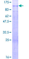 ab165281 on a 12.5% SDS-PAGE stained with Coomassie Blue.