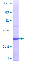 ab165282 on a 12.5% SDS-PAGE stained with Coomassie Blue.