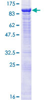 ab163616 on a 12.5% SDS-PAGE stained with Coomassie Blue.