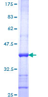 ab163617 on a 12.5% SDS-PAGE stained with Coomassie Blue.