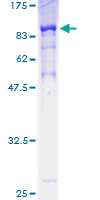 ab153243 on a 12.5% SDS-PAGE stained with Coomassie Blue.
