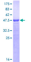 ab161117 on a 12.5% SDS-PAGE stained with Coomassie Blue.