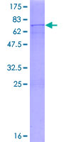 ab153264 on a 12.5% SDS-PAGE stained with Coomassie Blue.