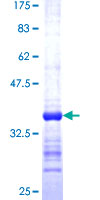 ab163385 on a 12.5% SDS-PAGE stained with Coomassie Blue.