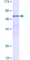 12.5% SDS-PAGE stained with Coomassie Blue.