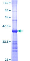 12.5% SDS-PAGE stained with Coomassie Blue.
