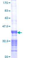 ab166352 on a 12.5% SDS-PAGE stained with Coomassie Blue.