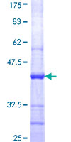 ab164514 on a 12.5% SDS-PAGE stained with Coomassie Blue.