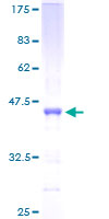 ab162407 on a 12.5% SDS-PAGE stained with Coomassie Blue.