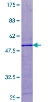 ab159155 on a 12.5% SDS-PAGE stained with Coomassie Blue.