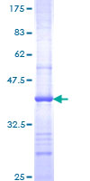 ab159156 on a 12.5% SDS-PAGE stained with Coomassie Blue.