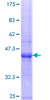 ab163185 on a 12.5% SDS-PAGE stained with Coomassie Blue.