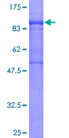 ab163189 on a 12.5% SDS-PAGE stained with Coomassie Blue.