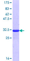 ab161076 on a 12.5% SDS-PAGE stained with Coomassie Blue.