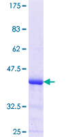 ab161055 on a 12.5% SDS-PAGE stained with Coomassie Blue.