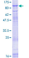 ab162286 on a 12.5% SDS-PAGE stained with Coomassie Blue.