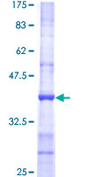ab162287 on a 12.5% SDS-PAGE stained with Coomassie Blue.
