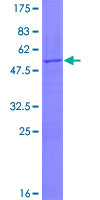 ab161150 on a 12.5% SDS-PAGE stained with Coomassie Blue.