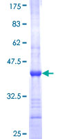 ab161151 on a 12.5% SDS-PAGE stained with Coomassie Blue.