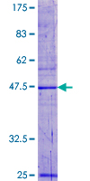 ab162526 on a 12.5% SDS-PAGE stained with Coomassie Blue.