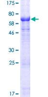ab163772 on a 12.5% SDS-PAGE stained with Coomassie Blue.