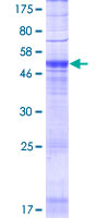 ab163800 on a 12.5% SDS-PAGE stained with Coomassie Blue.