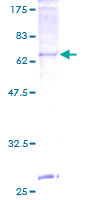 ab153496 on a 12.5% SDS-PAGE stained with Coomassie Blue.