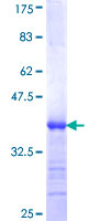 ab161765 on a 12.5% SDS-PAGE stained with Coomassie Blue.