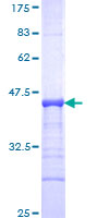 ab161806 on a 12.5% SDS-PAGE stained with Coomassie Blue.