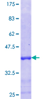 ab165377 on a 12.5% SDS-PAGE stained with Coomassie Blue.