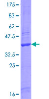 ab160260 on a 12.5% SDS-PAGE stained with Coomassie Blue.