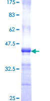 ab160748 on a 12.5% SDS-PAGE stained with Coomassie Blue.