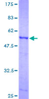 ab160110 on a 12.5% SDS-PAGE stained with Coomassie Blue.