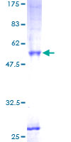 ab160111 on a 12.5% SDS-PAGE stained with Coomassie Blue.