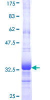 ab160112 on a 12.5% SDS-PAGE stained with Coomassie Blue.