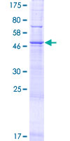 ab164664 on a 12.5% SDS-PAGE stained with Coomassie Blue.
