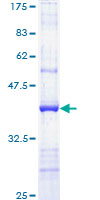 ab159162 on a 12.5% SDS-PAGE stained with Coomassie Blue.
