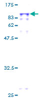 ab159165 on a 12.5% SDS-PAGE stained with Coomassie Blue.