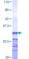 ab160054 on a 12.5% SDS-PAGE stained with Coomassie Blue.