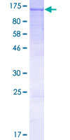 ab160052 on a 12.5% SDS-PAGE stained with Coomassie Blue.